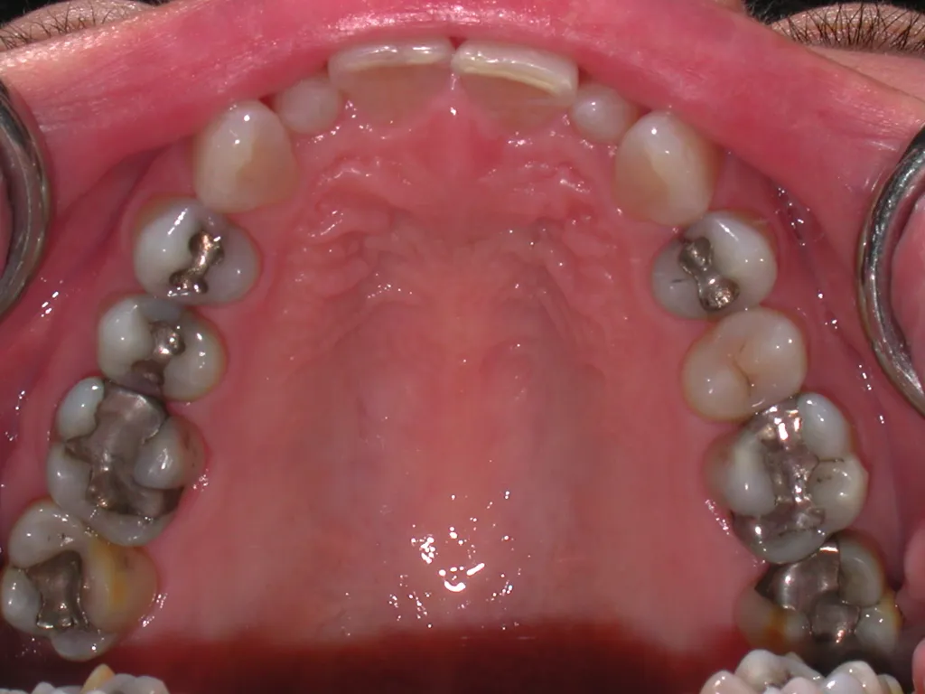 Smile gallery photo 1