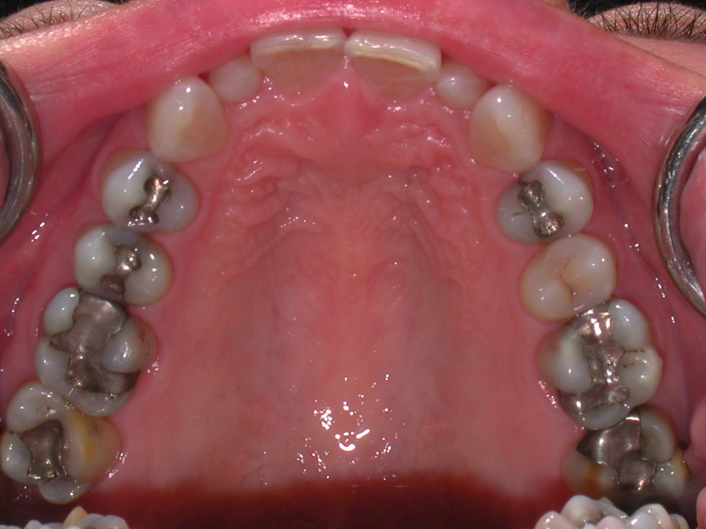 Up close photo of teeth