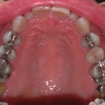 Up close photo of teeth