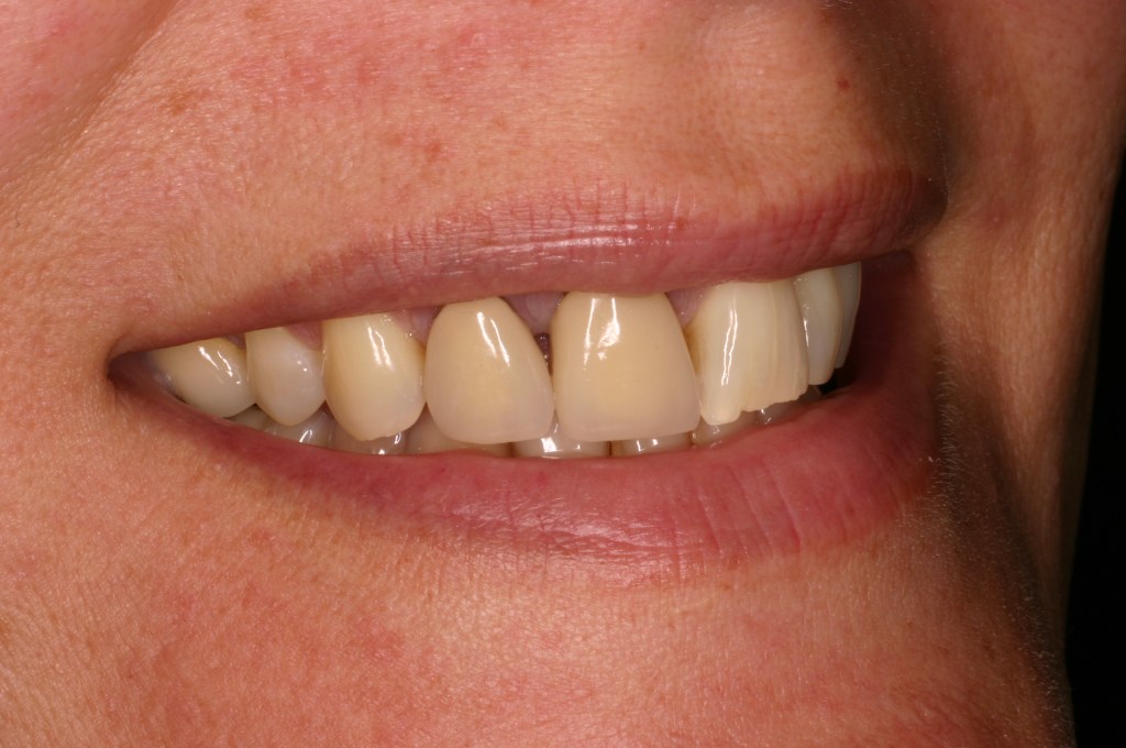 Up close photo of teeth