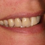 Up close photo of teeth