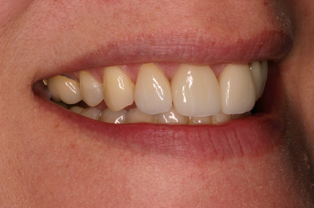 Up close photo of teeth