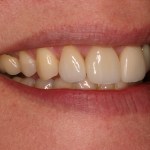 Up close photo of teeth