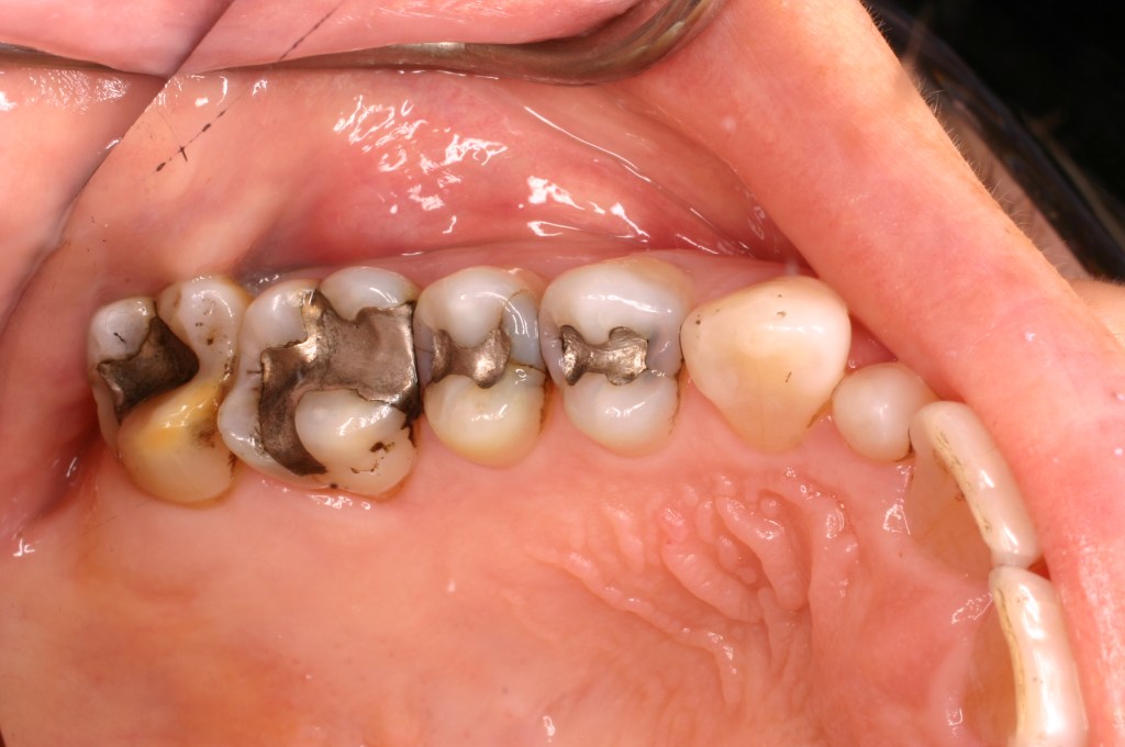 Up close photo of teeth