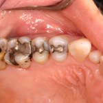 Up close photo of teeth