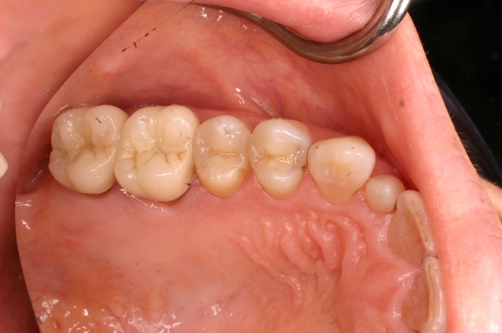Up close photo of teeth