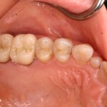 Up close photo of teeth