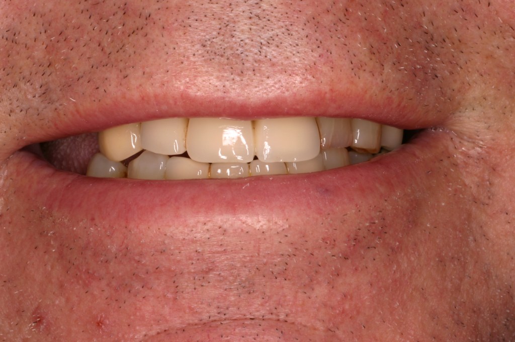 Up close photo of teeth