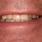 Up close photo of teeth