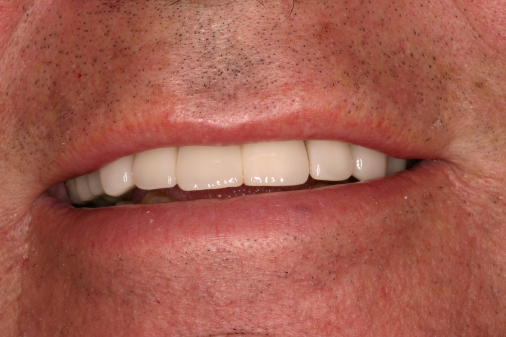 Up close photo of teeth