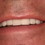Up close photo of teeth