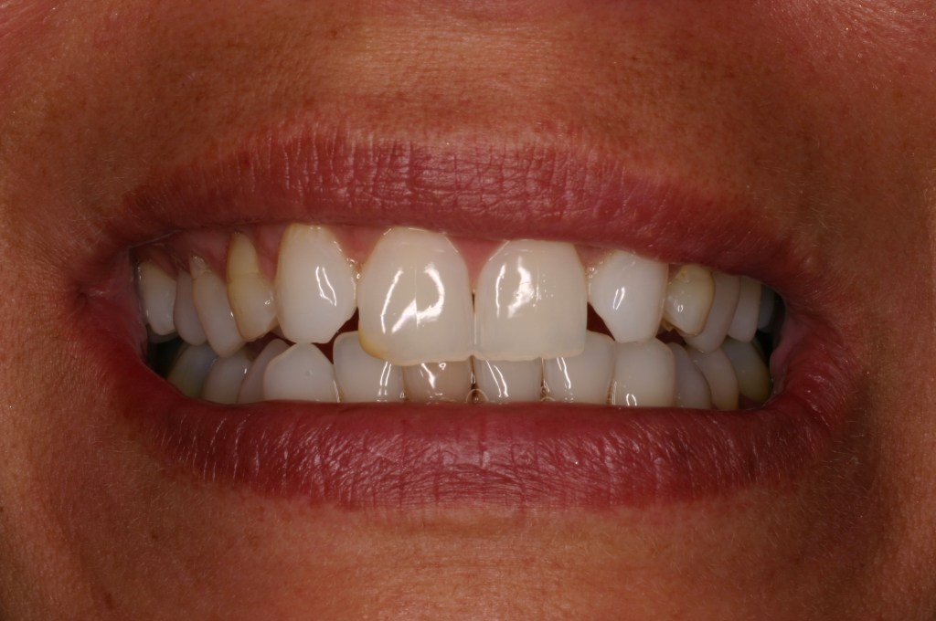 Up close photo of teeth