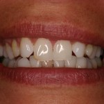 Up close photo of teeth