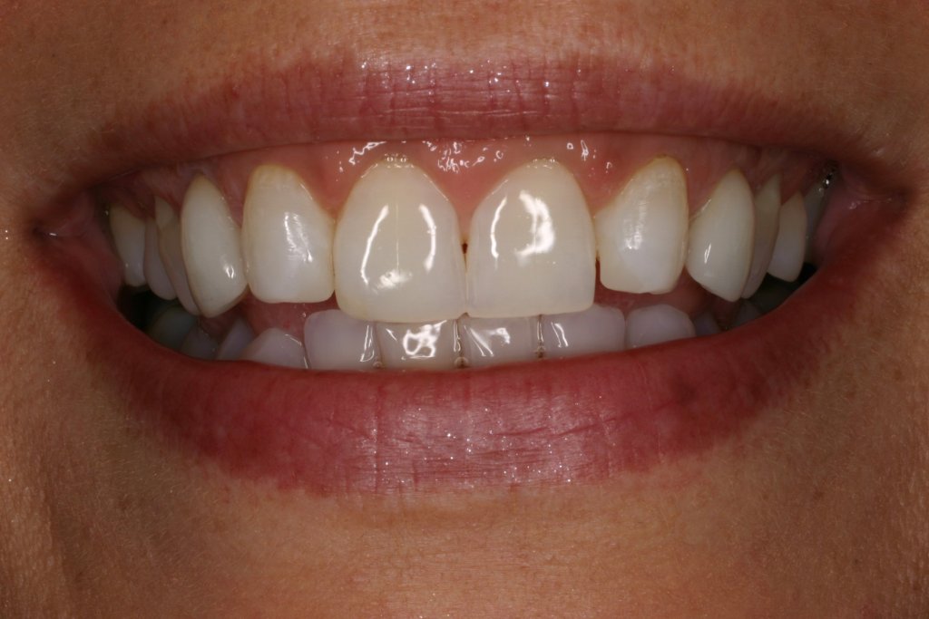Up close photo of teeth