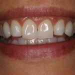 Up close photo of teeth