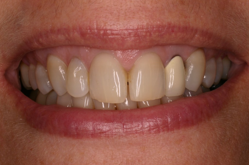 Up close photo of teeth