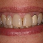 Up close photo of teeth