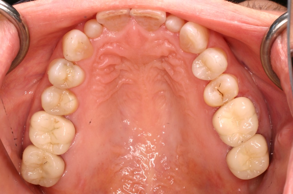 Up close photo of teeth