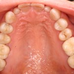 Up close photo of teeth