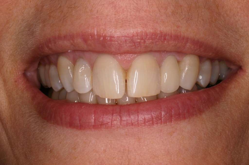 Up close photo of teeth
