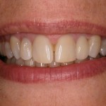Up close photo of teeth