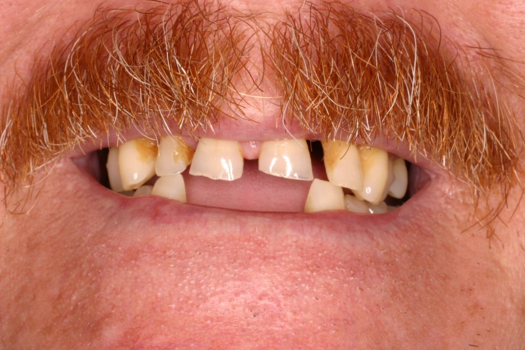 Up close photo of teeth