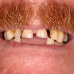 Up close photo of teeth