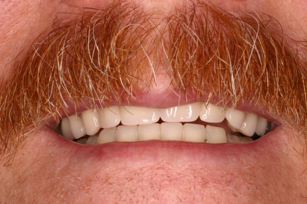 Up close photo of teeth