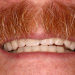 Up close photo of teeth