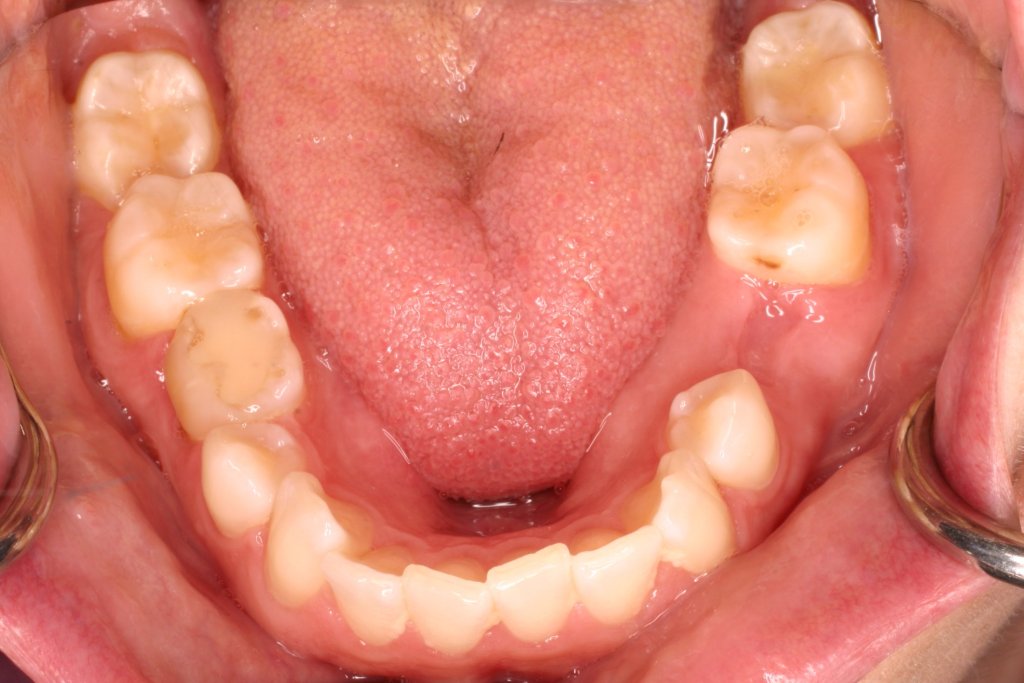 Up close photo of teeth