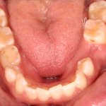 Up close photo of teeth
