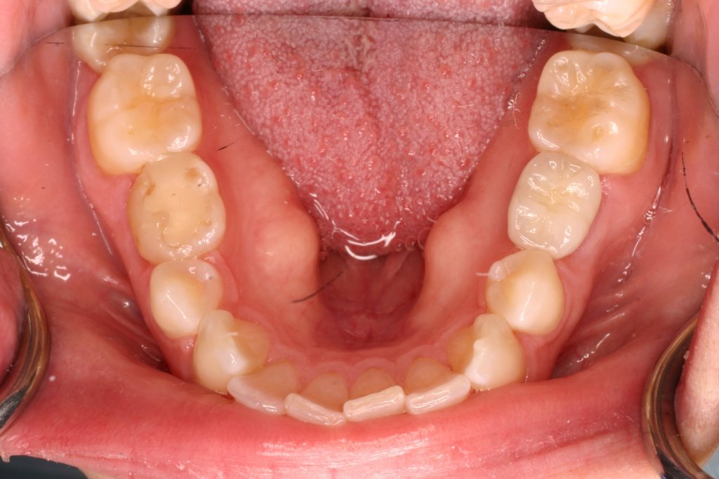 Up close photo of teeth