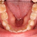 Up close photo of teeth
