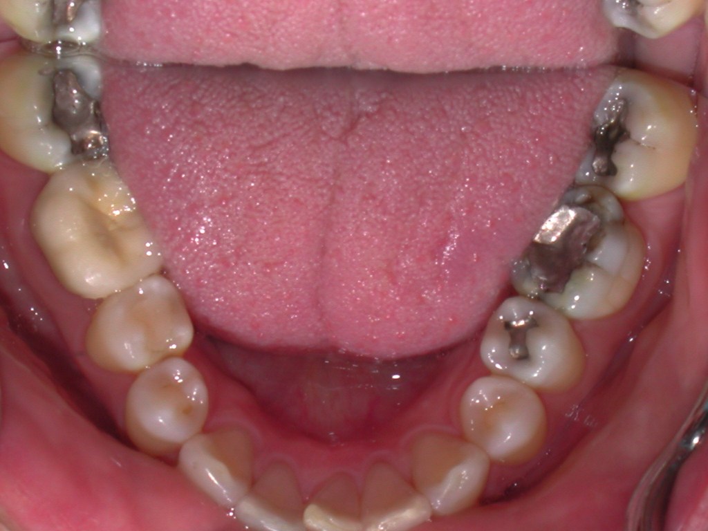 Up close photo of teeth