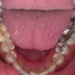 Up close photo of teeth