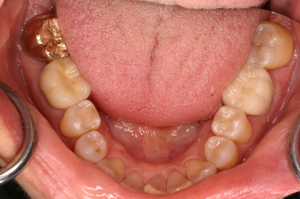 Up close photo of teeth