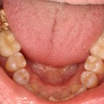 Up close photo of teeth