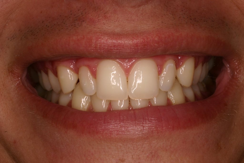 Up close photo of teeth