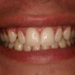 Up close photo of teeth