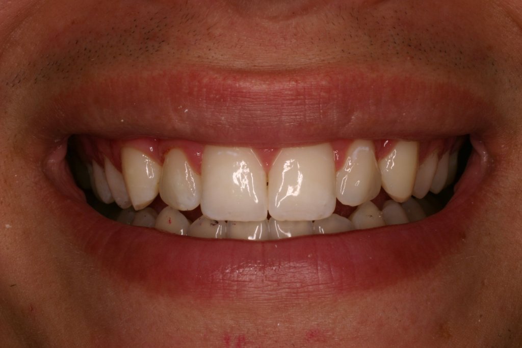 Up close photo of teeth