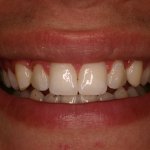 Up close photo of teeth