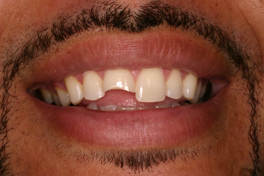 Up close photo of teeth