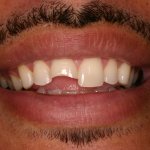Up close photo of teeth