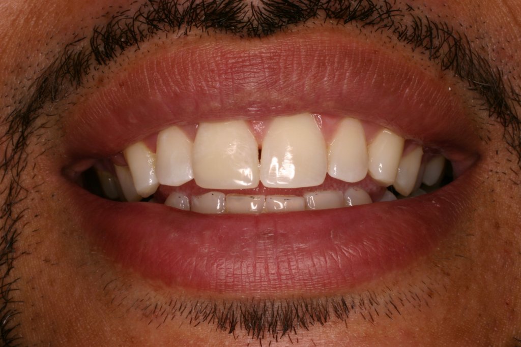Up close photo of teeth