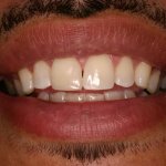 Up close photo of teeth