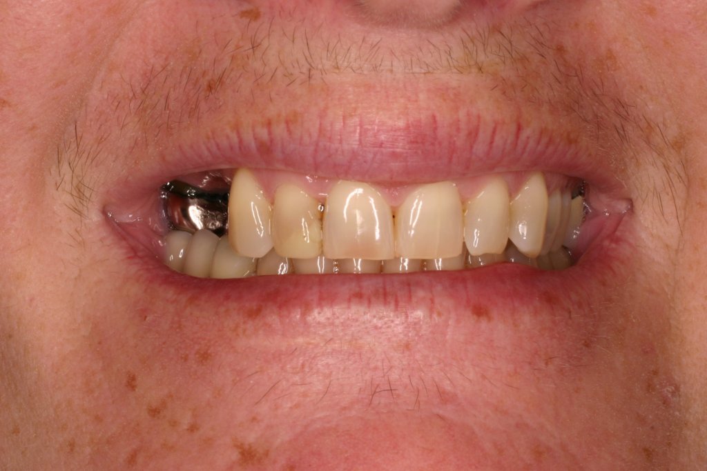 Up close photo of teeth