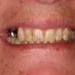 Up close photo of teeth