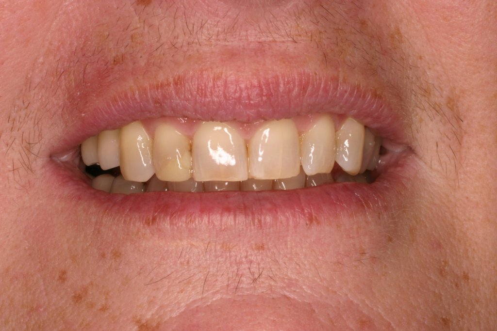 Up close photo of teeth