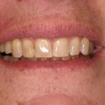 Up close photo of teeth