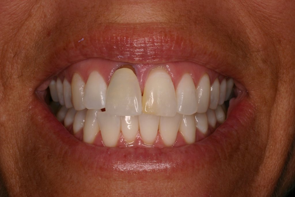 Up close photo of teeth